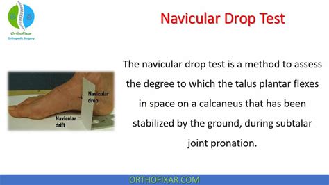 navicular drop test normal